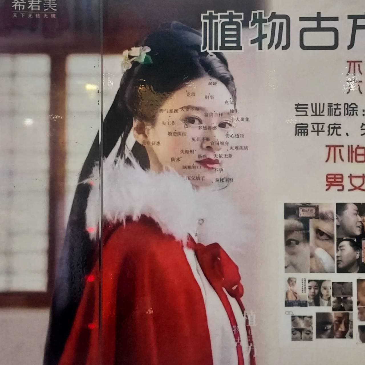 ホクロ･アザ除去の効能看板/台北龍山寺駅地下/占い街